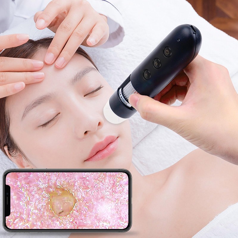 Scalp Detector, 800X Clear Image Hair Folicle Health Analyzer, Hair