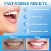 Milumber Teeth Whitening Strips for Sensitive, 42 Strips Whitener Safe