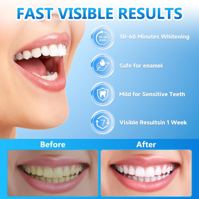 Milumber Teeth Whitening Strips for Sensitive, 42 Strips Whitener Safe