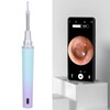 Smart Visible Ear Cleaner Wifi Visual Earwax Removal Kit 5MP