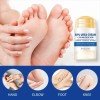 Crema Exfoliante Hidratante Para Pies Con 60% De Urea
