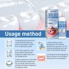 EELHOE 1/2/4pcs EELHOE Moldable Dental Gel Dentures Temporary Fillings Cavities