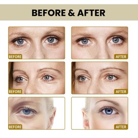 Eye Cream for Dark Circles and Puffy Eyes,Under Eye C/ream for Woman,Eye Cr/eam for Wrinkles,Eye Bags Serums,Eye Tightening Cream Instant,Eye Bags Remover Men,Lifting and Moisturizing Around the Eyes