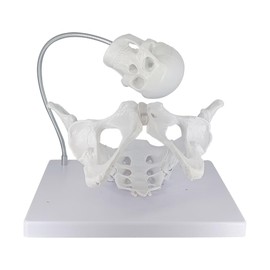 Pelvic Model with Baby,Female Pelvis Model with Fetal Skull，Female Pelvis Childbirth Model，Childbirth Education Tools，Childbirth Demonstration Pelvis Model，Midwifery Teaching Model