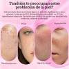 2pz Arbutin 7.0+txa 4.0.cream,cremas De Manchas Faciales