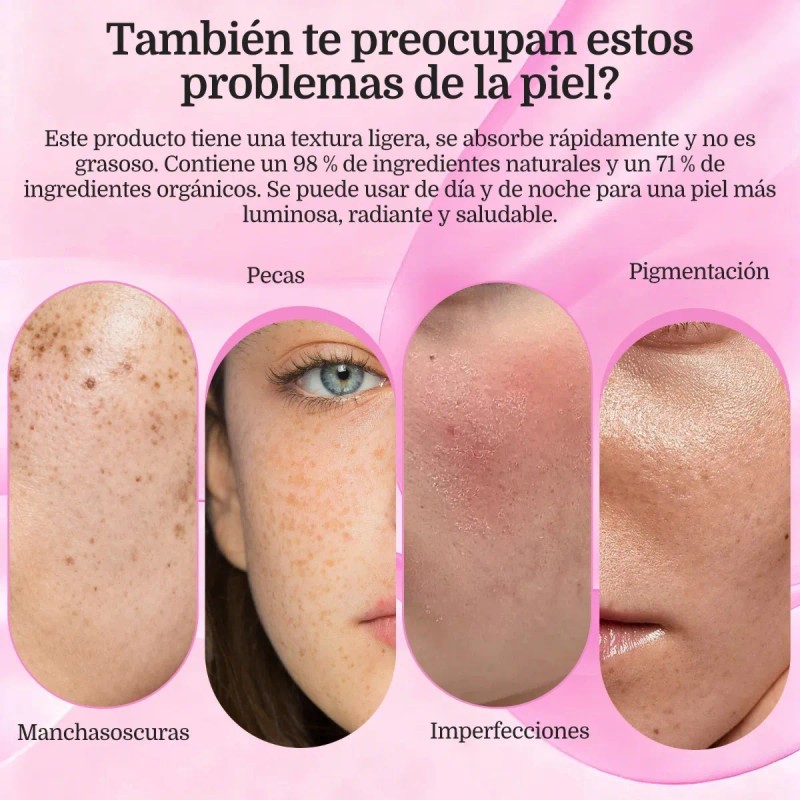 2pz Arbutin 7.0+txa 4.0.cream,cremas De Manchas Faciales