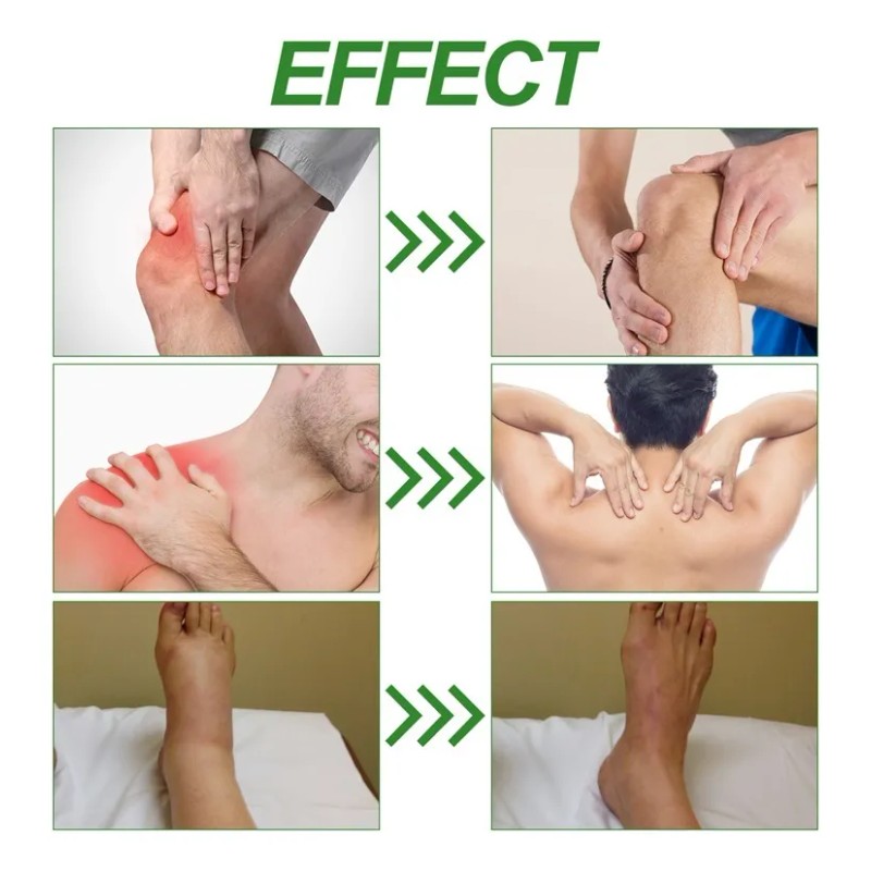 Bs Crema De Cuidado Articular Para Aliviar El Dolor