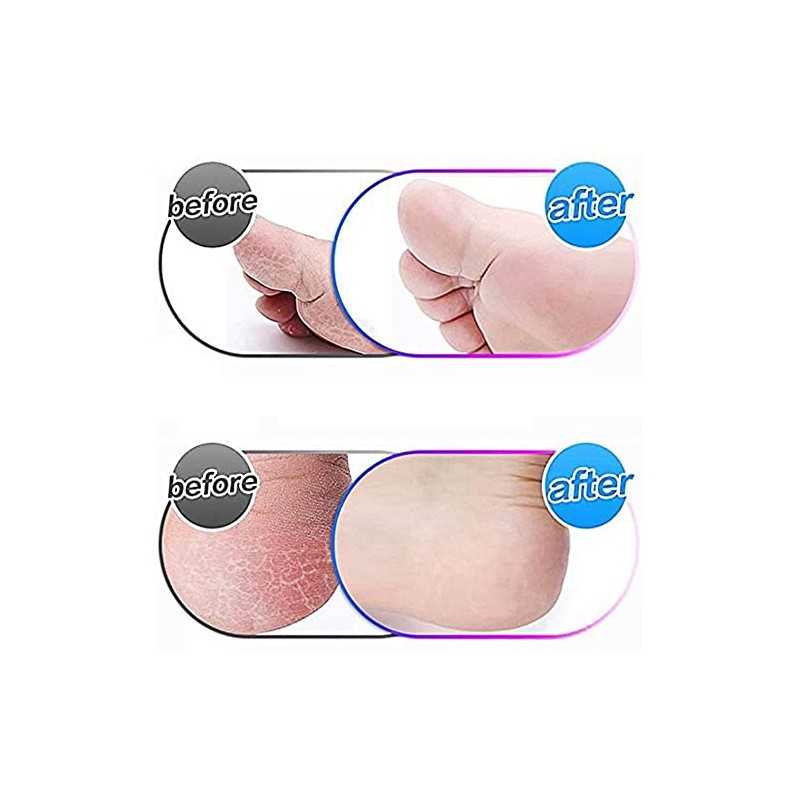 Hsthe Sea 4 Pack Extra Coarse Mineral Replacement Rollers Mineral