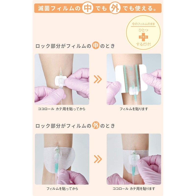 skinix YB-271924S Cushion Dressing for Cocolol Cates, Relieves Catheter Pressure,