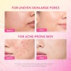 Crema Facial Noche Retinol Hpr Niacinamide Textura Desigual Piel Opaca