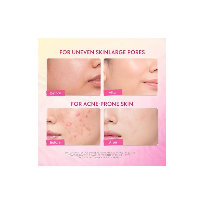 Crema Facial Noche Retinol Hpr Niacinamide Textura Desigual Piel Opaca