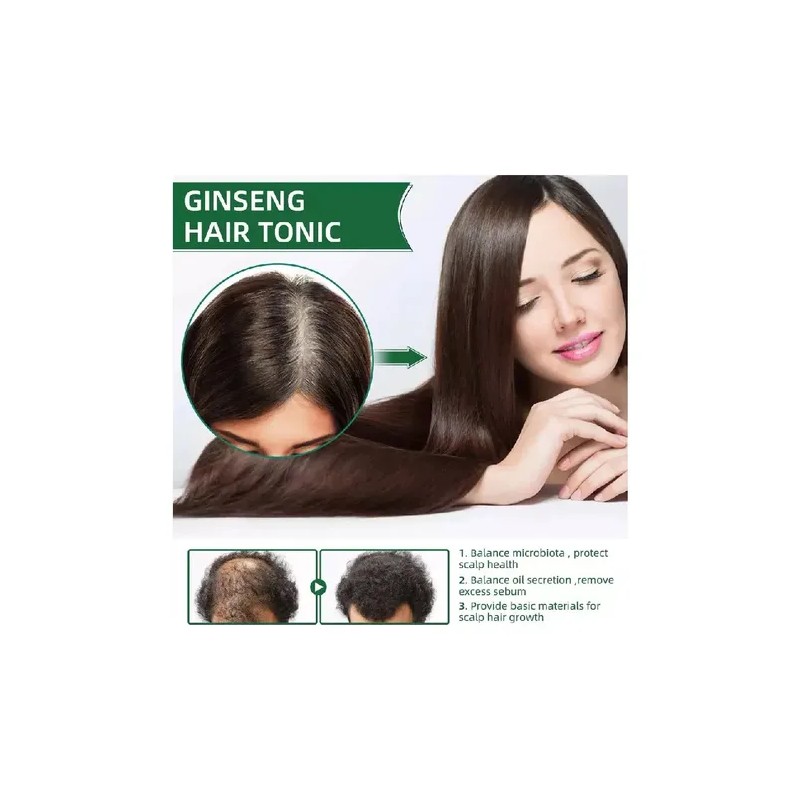 2025 . Productos Para El Cabello Loss Ouhoe Growth Prevent
