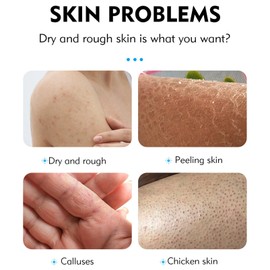 Urea Cream 40 Percent, Urea Foot Cream for Cracked Heels and Dry Skin, Cracked Heel Cream for Deep Moisturizing, Callus Remover Nourishes Soften, Foot Moisturiser for Women&Men, Body Care