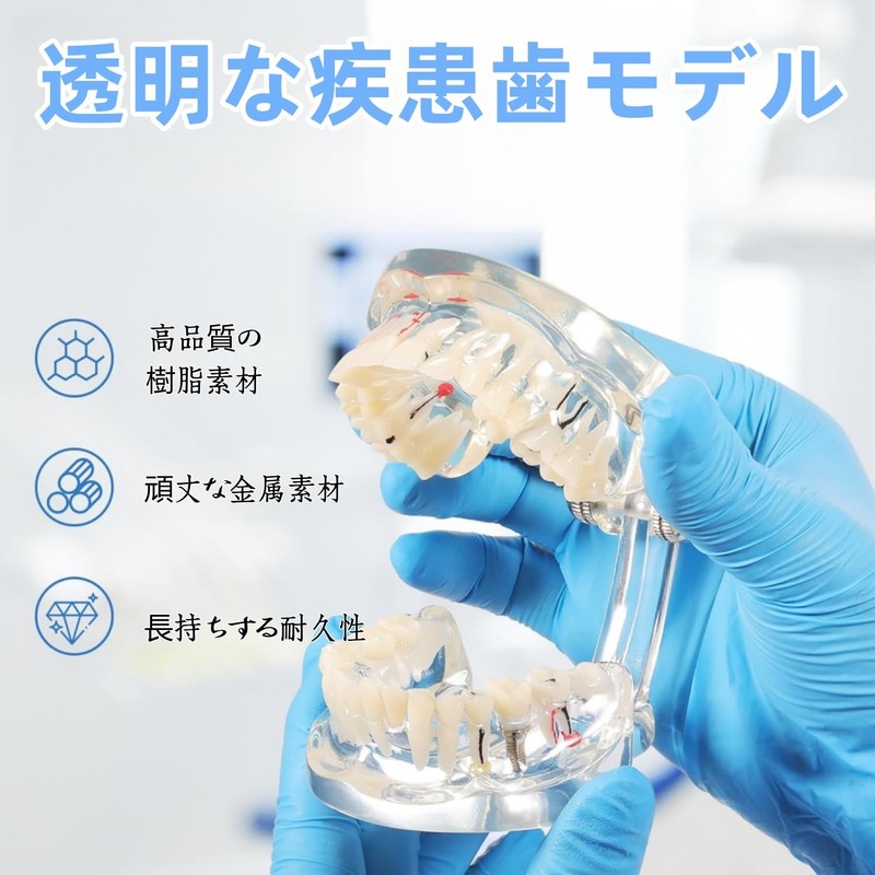 UKYCEORA Transparent Disease Teeth Model, Dental Implant Bridge Dental Teaching