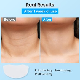 AUSLKA Neck Wrinkle Patches Moisturizing Hydrolyzed Collagen Mask, Neck Lifting Firming Pads for Tightening Skin 5 PCS, Collagen Masks for Looking Down Causes Wrinkles