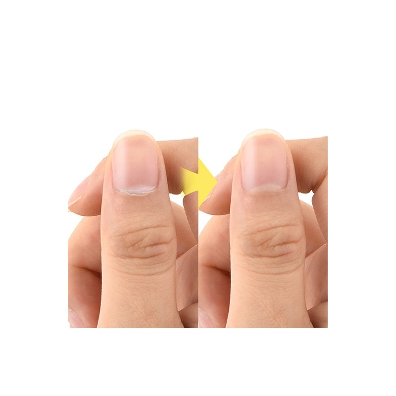 Soft Pineapple Cuticle Remover Nail Care Cuticle Soaking 10ml 1ea