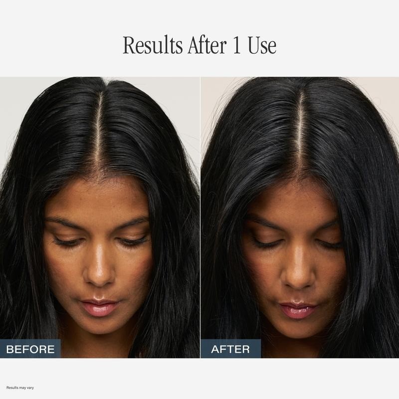 SKINN Cosmetics TRICHOLAB Shampoo & Conditioner Set – For Noticeably