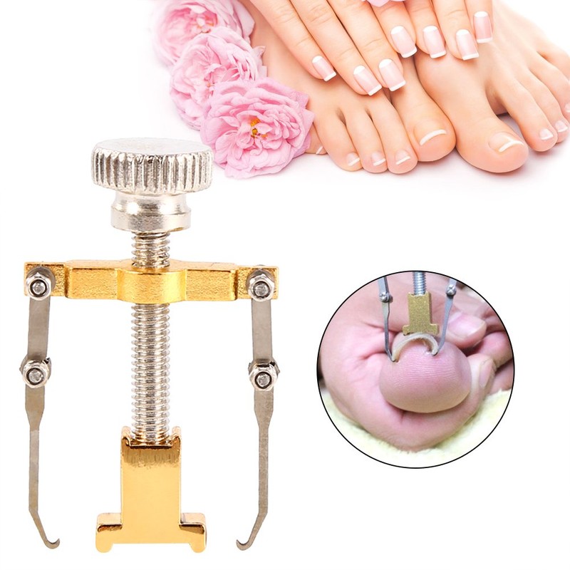 Ingrown Toenail Corrector, Practical Ingrown Toenail Tool Nail Kit Toe