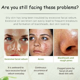 Acne Cream,Moisturiser Face Cream Spot Cream Mens Moisturiser Tea Tree Cream Spot Cream For Acne Cream Moisturiser for Women Men Teenagers Dilute Face Prone Spot Marks Balance Facial Oil Cream