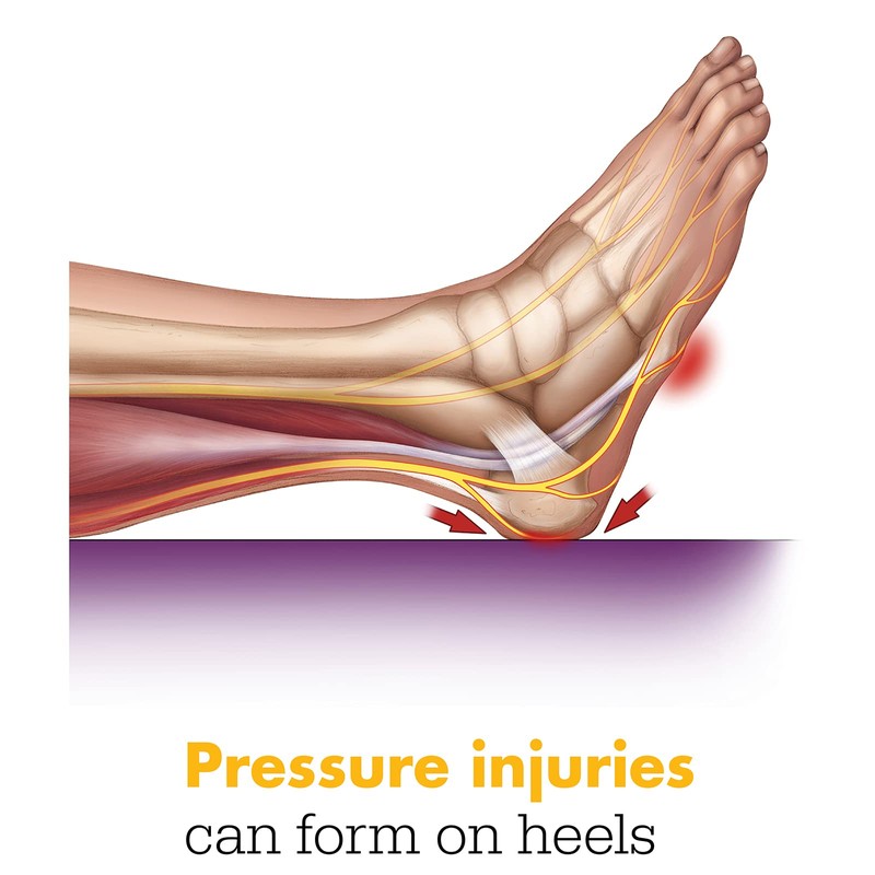 Sage Stryker Prevalon Heel Protector III – 1 Heel Protector