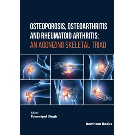 Osteoporosis, Osteoarthritis and Rheumatoid Arthritis: An Agonizing Skeletal Triad