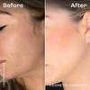 Cosmetic Consult Miracle Skin Transformation By Ashley Stobart | Rejuvenates