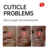 D Exfoliante Para El Cuidado De Los Pies Para Comer