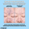 Peace Out Skincare - Perfeccionador Instantáneo De Poros, Im