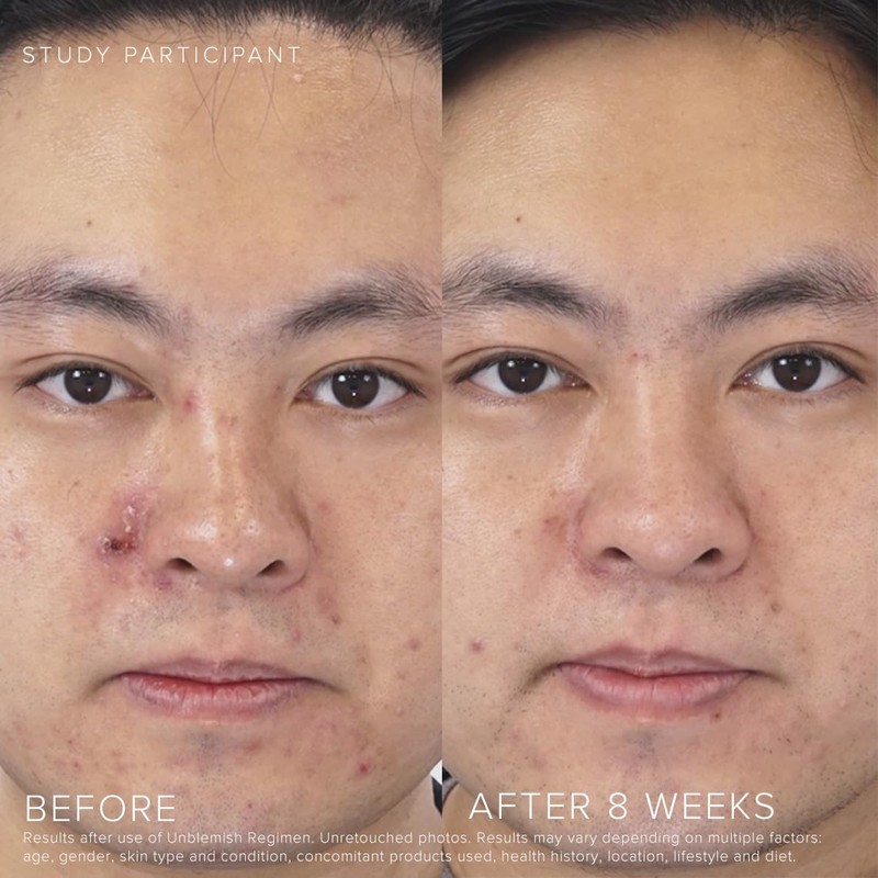 Rodan + Fields UNBLEMISH Invisible Matte Defense Broad Spectrum SPF