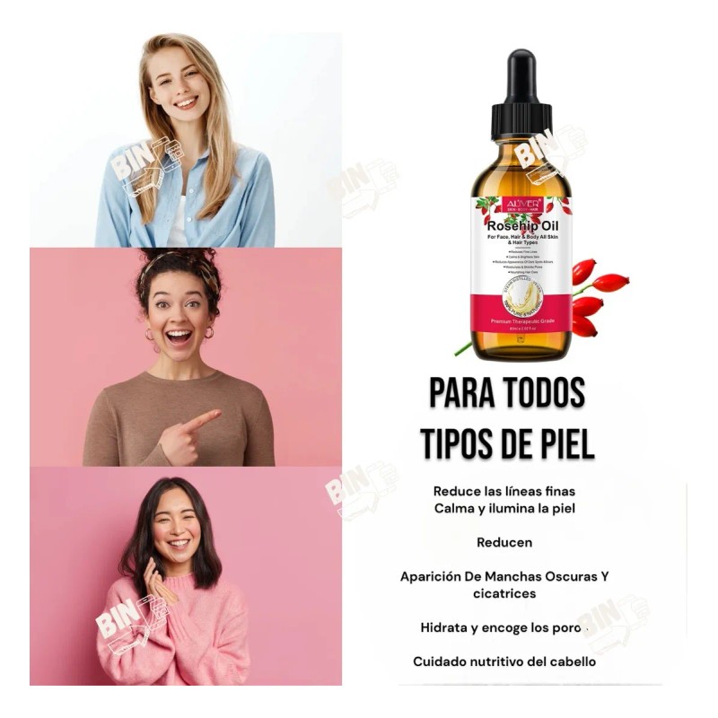 Aceite Esencial Rosa Mosqueta 100% Puro Natural Irlandes