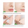 Bluemega Skin Cream Crema Aclaradora Piel Íntima