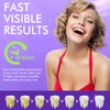Teeth Whitening Strips, Purple Tooth Whitening Strips 14 Treatments, Enamel