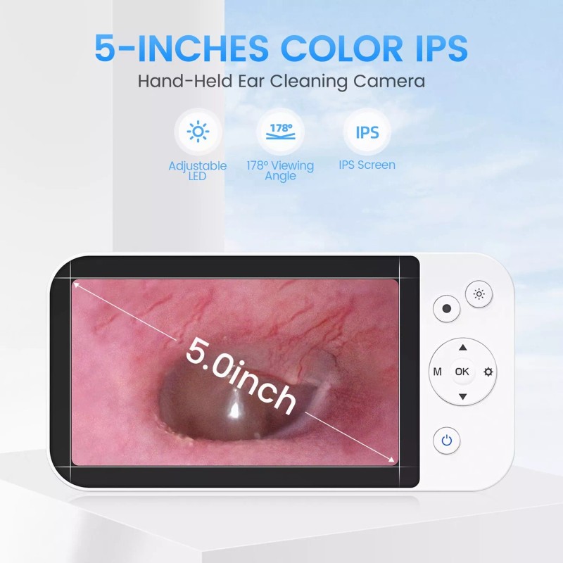 ScopeAround 3.9mm Otoscope Camera Ear Wax Removal inspection camera 1080P