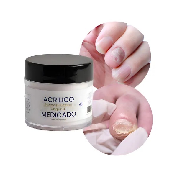 Acrilico Secante Para Uñas Con Hongos, Manos Y Pies 1