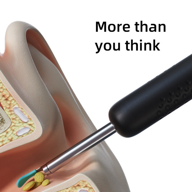 Ear Wax Removal Tool with 1080P Camera Wireless Connected 6