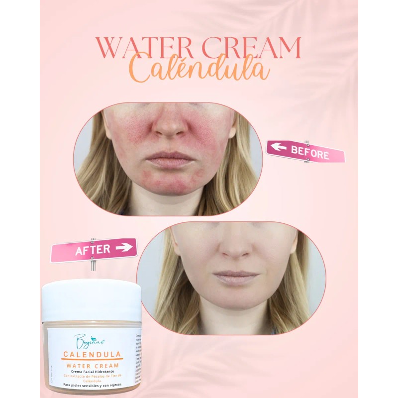 Biogenné Gel Crema Calendula 50 Ml Piel Con Rosácea