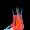 Ankle Braces Comfortable Breathable Double Pressure Ankle Support Brace for
