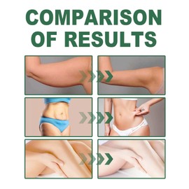 Collagen Lifting Body Oil - Firming, Moisturizing, and Massage Oil for Skin Tightening, Scars, Wrinkles, and Stretch Marks - Ultimate Skin Care Solution