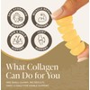 Lurelle Collagen Gummies for Women – 1000mg Collagen per Gummy