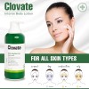 Loción Clovate Intense Con Ácido Láctico | 400 Ml |