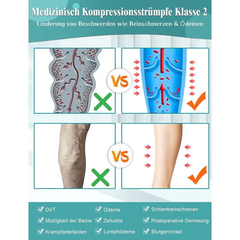 Evolyline 20-30 mmhg Medical Compression Stockings Women's Men's Leggings