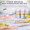 Hydrocortisone Cream 1% w/w Bite and Sting Cream, Mosquito and