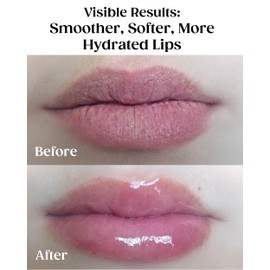 KAPLAN MD Perfect Pout Lip Mask & SPF 30 Lip Balm Duo – Hydrating Treatment with Hyaluronic Acid – Lip Mask (1 oz) + Rose Blush Balm (0.35 oz)