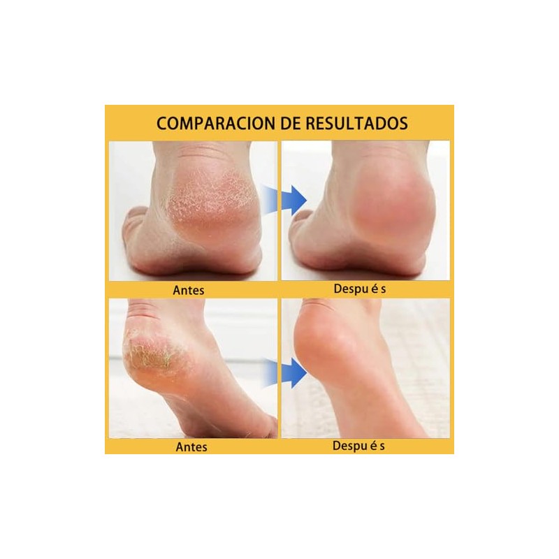 2pcs Crema Hidratante para Pies, Crema Renovadora de Pies,Blsamo Para
