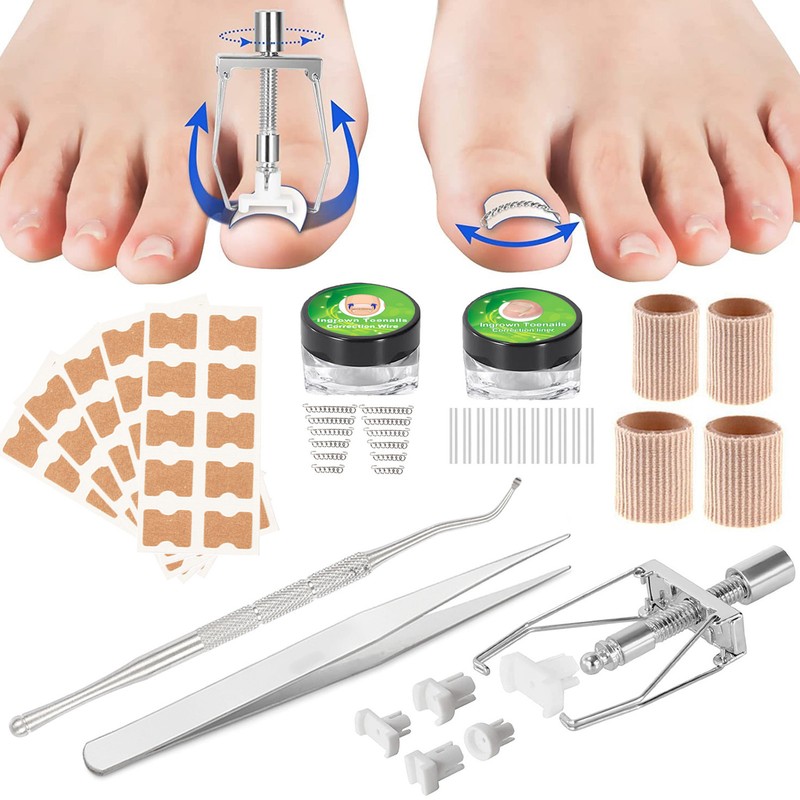 Ingrown Toenail Treatment Kit Glue Free Pedicure Ingrown Toenail Corrective