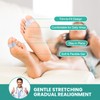 Welnove Pack of 12 Bunion Corrector, Toe Separators with 2