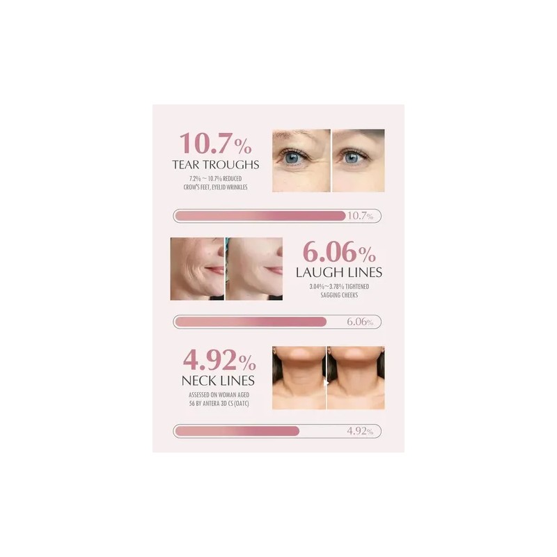 Blsamo Mltiple Kahi Seoul Wrinkle Bounce, 9 G