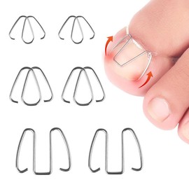 6 Pcs 3 Sizes Ingrown Toenail Wire Toenail Corrector Recover Care Nail Tool Stainless Steel Ingrown Toenail Correction for Ingrown Toenails Care Curve Correct Ingrown Toenail Treatment