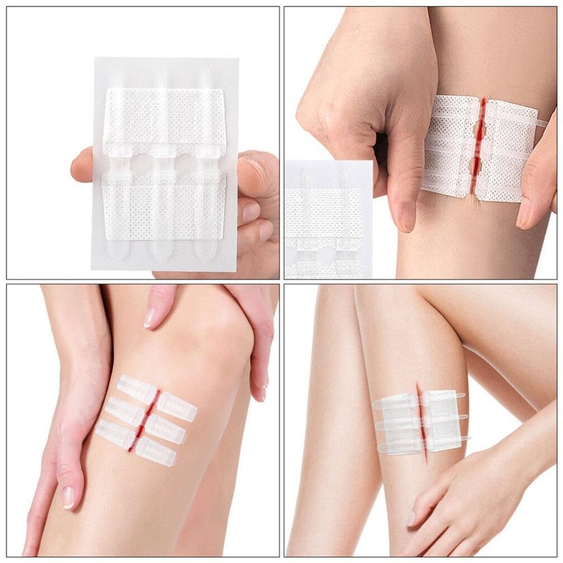 Beavorty 1 Set Zip Stitch with Wound Dresssings WoundClosure Strips