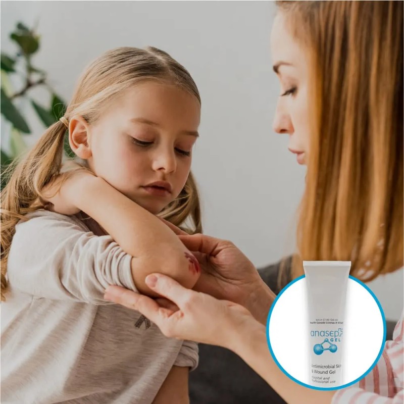 Anacapa Technologies Inc Anasept-antimicrobiano Gel Para Pie